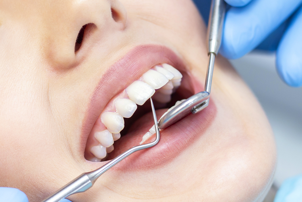 How Dental Tourism is Shaping the Teeth Whitening Industry