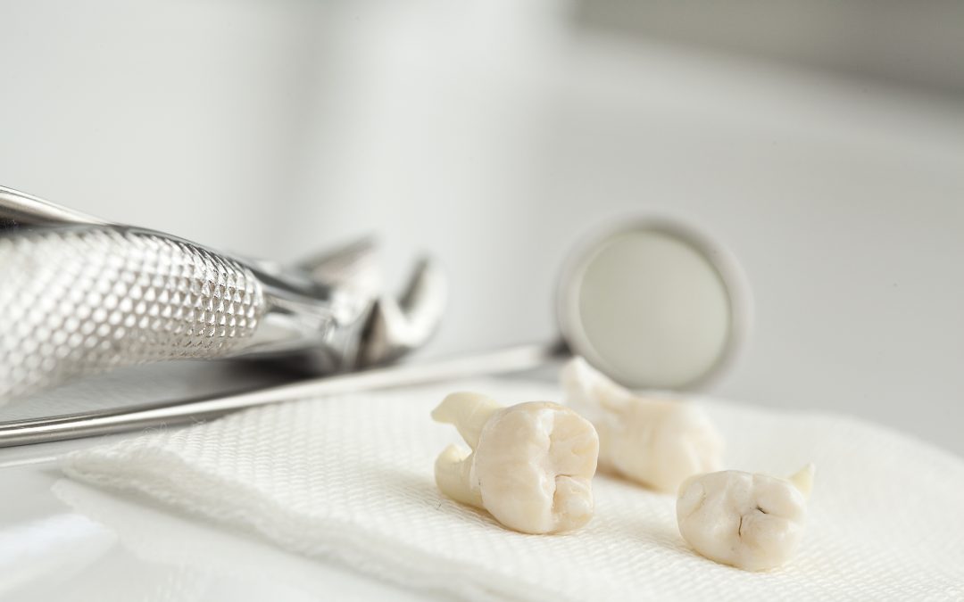 How Periodontal Health Affects Dental Implant Success